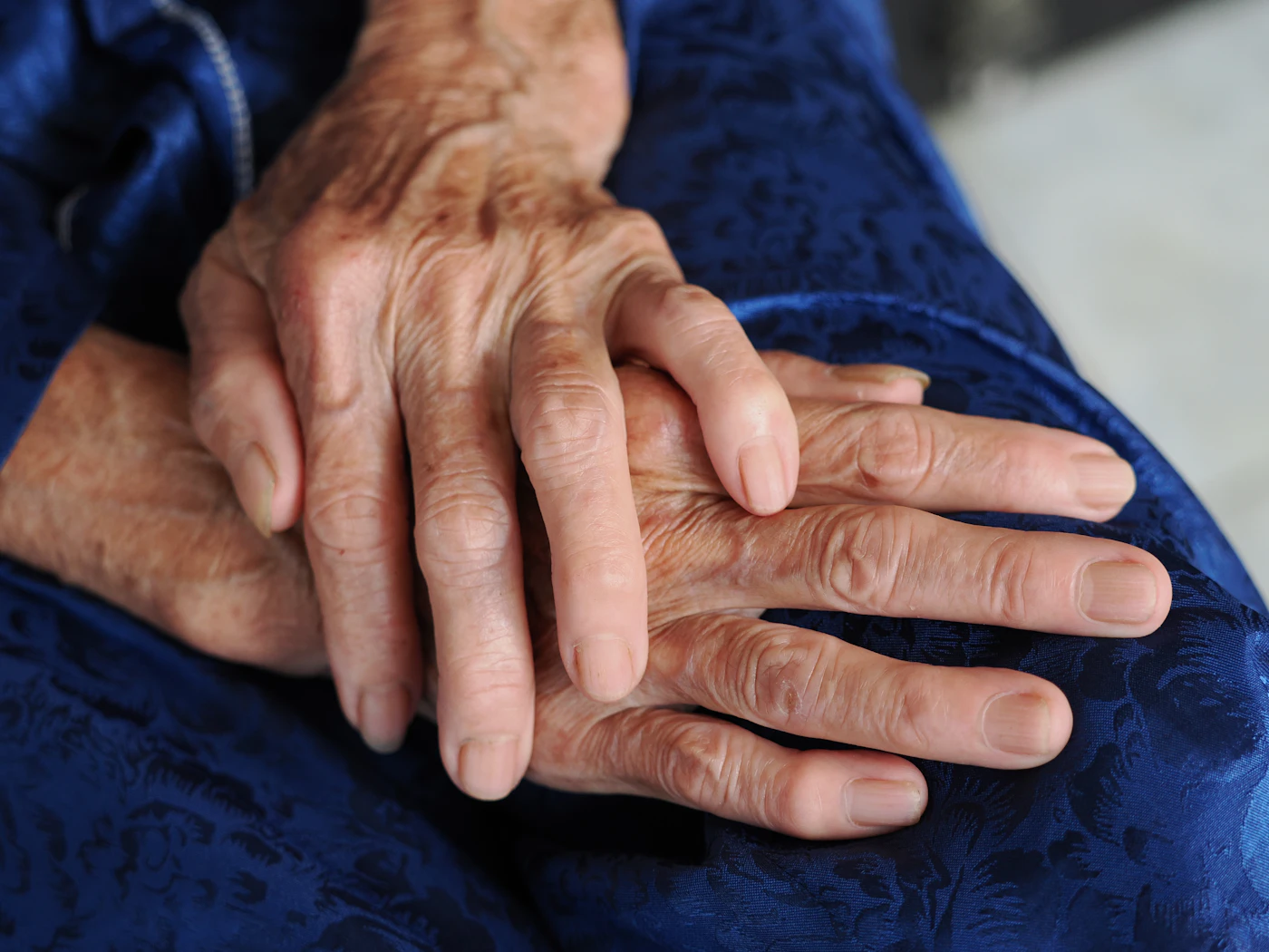 Close-up of elderly hands resting calmly, representing ongoing patient care